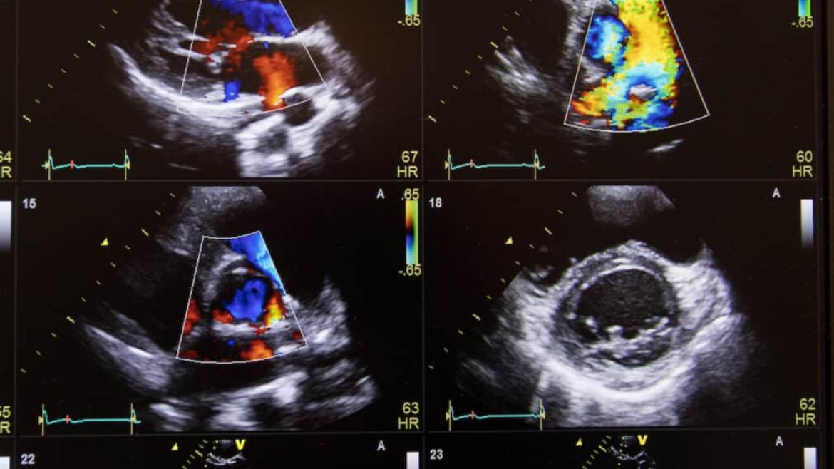 PFAS Ultrasound.jpg